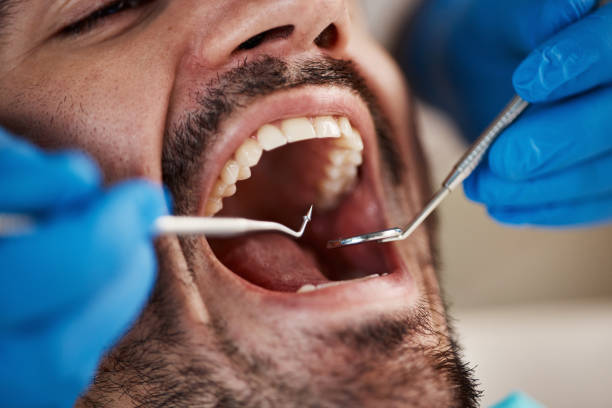 Best Emergency Dental Filling Replacement  in Longboat Key, FL